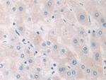PYGB Antibody in Immunohistochemistry (Paraffin) (IHC (P))