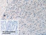 PYGB Polyclonal Antibody