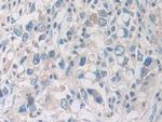 PYGB Antibody in Immunohistochemistry (Paraffin) (IHC (P))