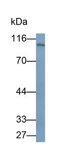 PYGB Antibody in Western Blot (WB)
