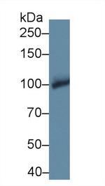 PYGB Antibody in Western Blot (WB)