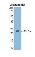 PYGL Antibody in Western Blot (WB)