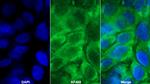 PYGL Polyclonal Antibody