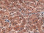 PYGL Antibody in Immunohistochemistry (Paraffin) (IHC (P))