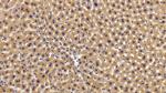 PYGL Antibody in Immunohistochemistry (Paraffin) (IHC (P))
