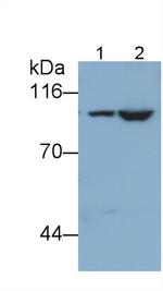 PYGL Antibody in Western Blot (WB)