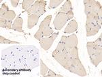 PYGM Antibody in Immunohistochemistry (Paraffin) (IHC (P))
