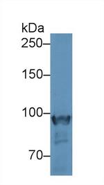 PYGM Antibody in Western Blot (WB)