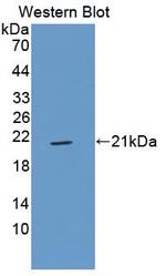 CD42a Antibody in Western Blot (WB)