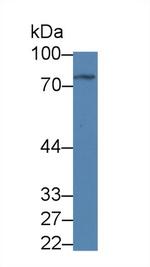C1orf85 Antibody in Western Blot (WB)