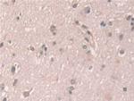 Grancalcin Antibody in Immunohistochemistry (Paraffin) (IHC (P))