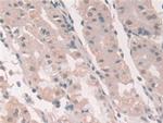 Grancalcin Antibody in Immunohistochemistry (Paraffin) (IHC (P))