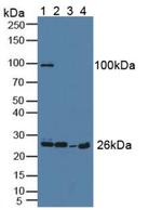 Grancalcin Antibody in Western Blot (WB)