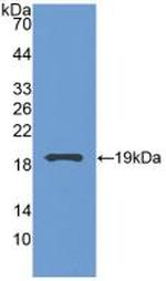 Grancalcin Antibody in Western Blot (WB)