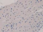 GAB3 Antibody in Immunohistochemistry (Paraffin) (IHC (P))