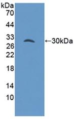 GAB3 Antibody in Western Blot (WB)