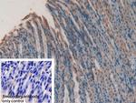GREM1 Polyclonal Antibody