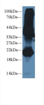 GREM1 Antibody in Western Blot (WB)