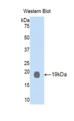 GDF1 Polyclonal Antibody