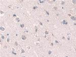 GRB10 Antibody in Immunohistochemistry (Paraffin) (IHC (P))
