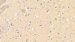 GRB10 Antibody in Immunohistochemistry (Paraffin) (IHC (P))