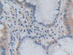 GH2 Polyclonal Antibody