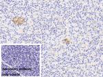 GDA Antibody in Immunohistochemistry (Paraffin) (IHC (P))