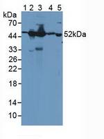 GDA Antibody in Western Blot (WB)