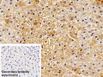Haptoglobin Polyclonal Antibody