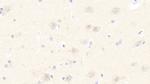 DNAJC4 Antibody in Immunohistochemistry (Paraffin) (IHC (P))