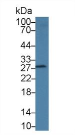 DNAJC4 Antibody in Western Blot (WB)