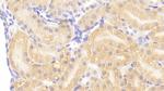 HSPBP1 Polyclonal Antibody