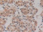 HSPA1A Antibody in Immunohistochemistry (Paraffin) (IHC (P))