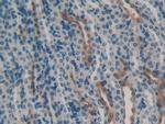 HSPA1B Antibody in Immunohistochemistry (Paraffin) (IHC (P))