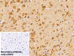 HSPA1B Antibody in Immunohistochemistry (Paraffin) (IHC (P))