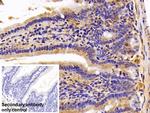 HSPA1B Antibody in Immunohistochemistry (Paraffin) (IHC (P))