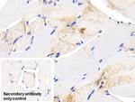 HSP27 Antibody in Immunohistochemistry (Paraffin) (IHC (P))