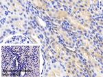 HSP27 Antibody in Immunohistochemistry (Paraffin) (IHC (P))