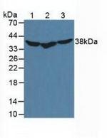 HSP40 Antibody in Western Blot (WB)