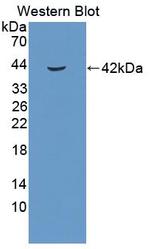 HSP40 Antibody in Western Blot (WB)