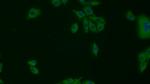 HSP60 Polyclonal Antibody