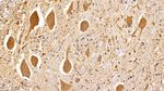 HSP60 Antibody in Immunohistochemistry (Paraffin) (IHC (P))