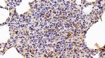 HSP60 Antibody in Immunohistochemistry (Paraffin) (IHC (P))