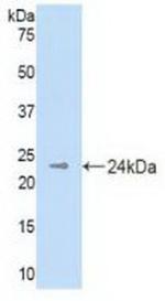 DHH Antibody in Western Blot (WB)
