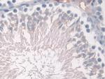 Hemoglobin alpha-1 Antibody in Immunohistochemistry (Paraffin) (IHC (P))