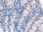Hemoglobin alpha-1 Antibody in Immunohistochemistry (Paraffin) (IHC (P))