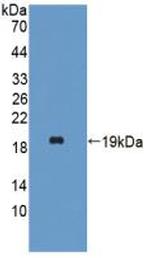 Hemoglobin alpha-1 Antibody in Western Blot (WB)