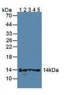 Hemoglobin alpha-1 Antibody in Western Blot (WB)