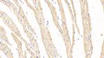 HBB Polyclonal Antibody