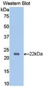 HBB Antibody in Western Blot (WB)